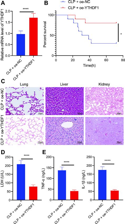 Overexpression Of YTHDF1 Inhibits Inflammation In CLP Induced Septic