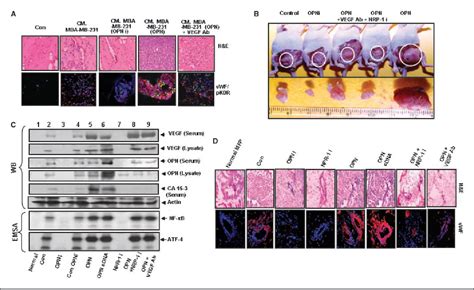 Figure From Autocrine And Paracrine Mechanisms Dependent Breast Tumor