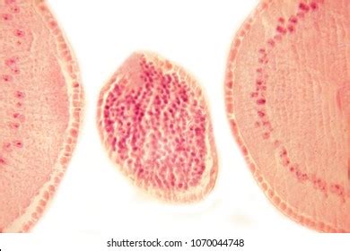 Human Worm Under Microscope Stock Photo 1070044748 | Shutterstock