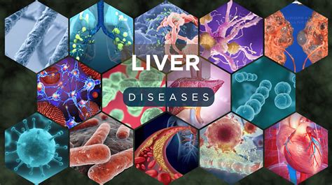 Liver Diseases Explained – Causes, Symptoms, & Treatments - FCTI Inc.