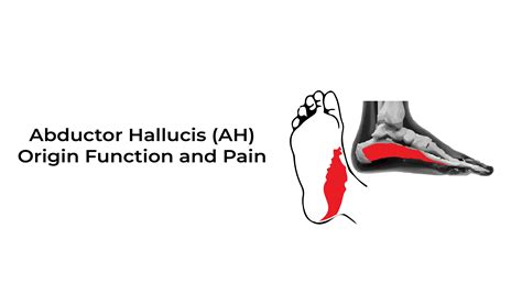 Abductor Hallucis Ah Origin Function And Pain Statcardiologist