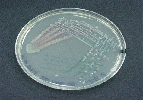 Pseudomonas Aeruginosa On Nutrient Agar