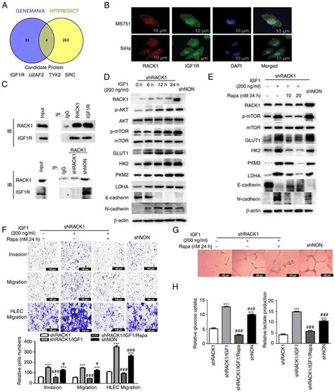 Rack Interacts With Igf R Promotes The Glycolysis Aggressiveness And