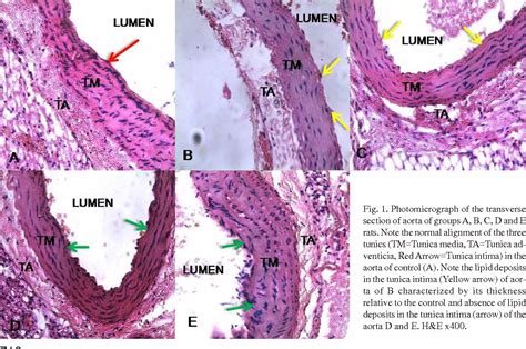 Histology Of Aorta