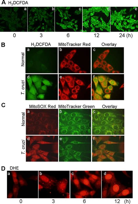 T Cruzi Induced Ros Production In Ac Cardiomyocytes A Ac