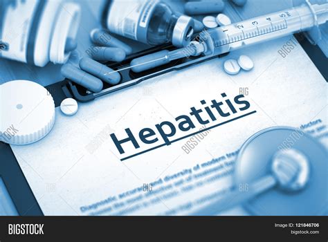 Hepatitis Diagnosis. Image & Photo (Free Trial) | Bigstock