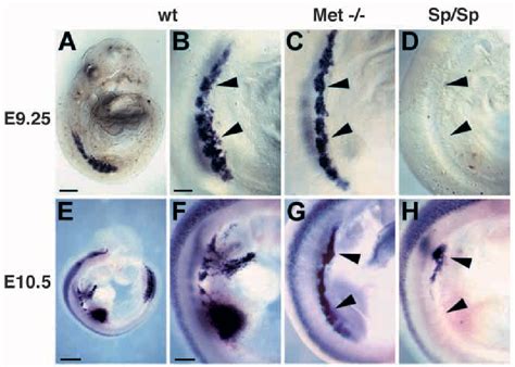 Figure From The Role Of Sf Hgf And C Met In The Development Of