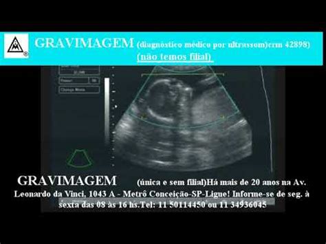 Gravimagem Ultrassom Morfol Gico D D Em Gravidez Semanas