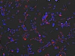 Invitrogen Low Density Lipoprotein From Human Plasma PHrodo Green