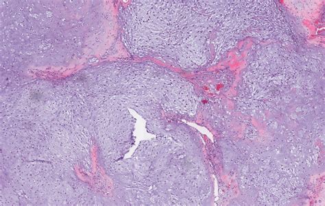 Pathology Outlines WHO Classification