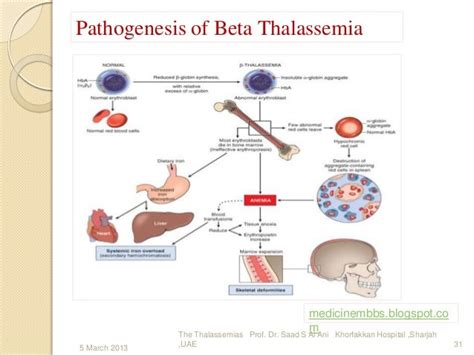 The Thalassemias