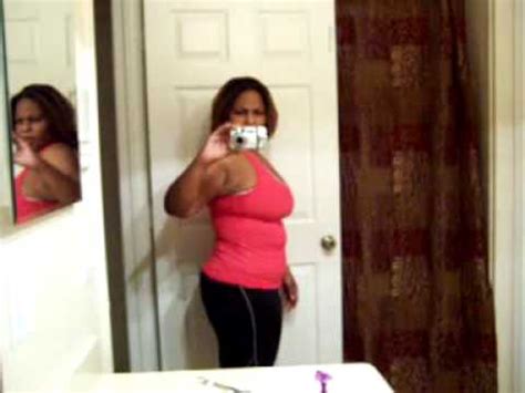 WLS Lapband 1 Year POST Op FULL BODY YouTube