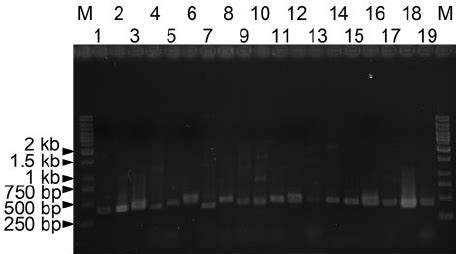 Photographs Of Ethidium Bromide Stained Gels Showing Amplification