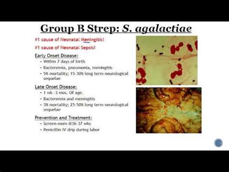 Streptococcus Group B