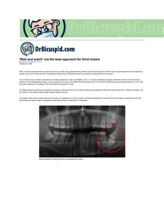 Why We Remove Wisdom Teeth That Aren T Hurting PDF