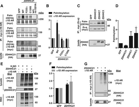 The Protein Acyl Transferase ZDHHC21 Modulates α1 Adrenergic Receptor