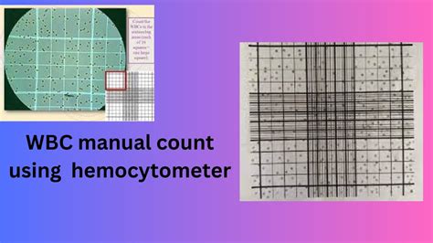 Wbc Manual Count Using Hemocytometer Youtube