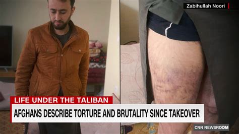 Afghans Describe Torture And Brutality Since Taliban Takeover Cnn