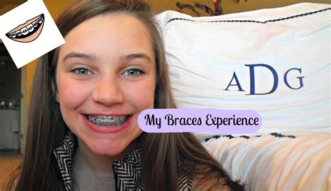 My Braces Experience All About Braces Youtube