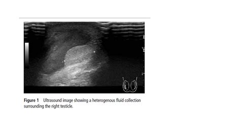 Scrotal Hematoma Dog