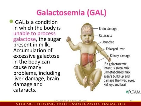 What is Galactosemia??