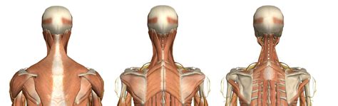 Forward Head Posture Muscles