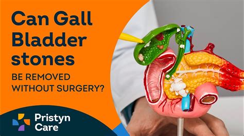 Gallbladder Stones Treatment Without Operation