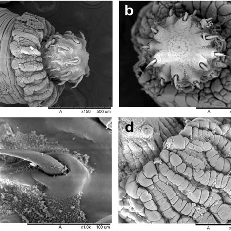 Scanning Electron Microscopy Observations Of P Elegans Adults