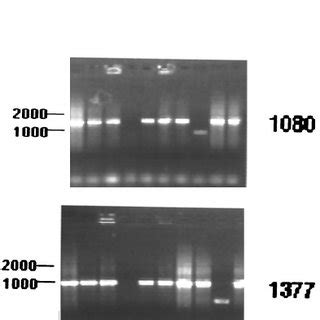 Agarose Gel Showing PCR Amplification Of DNA Of M Bovis With Pattern A