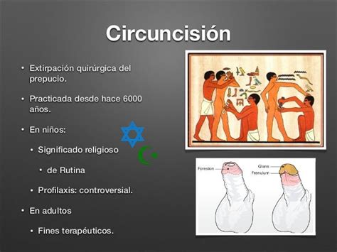 Vasectomía Y Circuncision