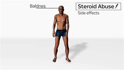 Steroids Side Bad Effects