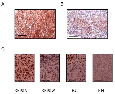 Analysis Of The Chips A Derived Tumour A Expression Of Cd117 Or Download Scientific Diagram