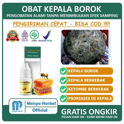 Jual Obat Borok Di Kepala Kulit Kepala Kering Bersisik Gatal Kulit