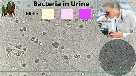 Bcye Agar Composition Clearance Sale Gbu Presnenskij Ru