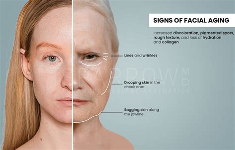 Understanding Facial Aging