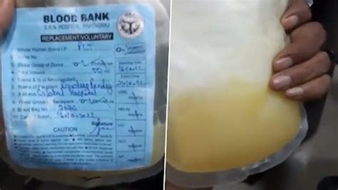 UP Global Hospital Which Gave Mosambi Juice As IV Drip To Dengue