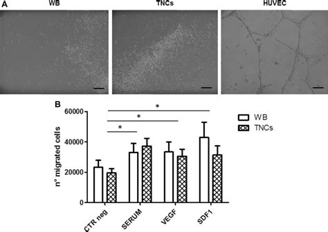 A Capillary Tube Formation Assay N 6 Formation Of Tubular Like