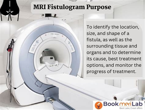 Mri Fistulogram Price Purpose Procedure Result