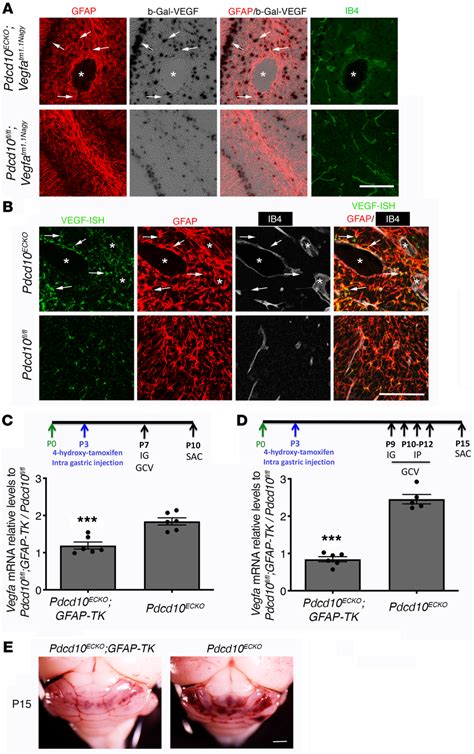 Astrocyte Derived Vegf Increased During Cerebral Cavernous Malformation