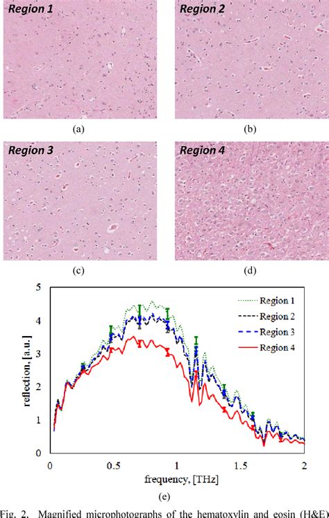 Figure From Thz Imaging Of Alzheimer S Disease Spectroscopic