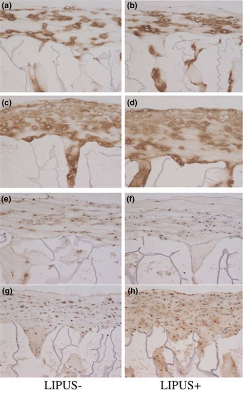 High Magnification Sections Of Chondrocytecollagen Sponges 1 And 2