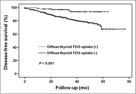 Incidental Diffuse Thyroid 18f Fdg Uptake Related To Autoimmune