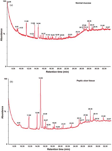 Typical Gc Ms Total Ion Current Tic Chromatograms A Chromatogram