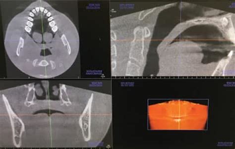 The Safe And Effective Use Of Cone Beam Computed Tomography