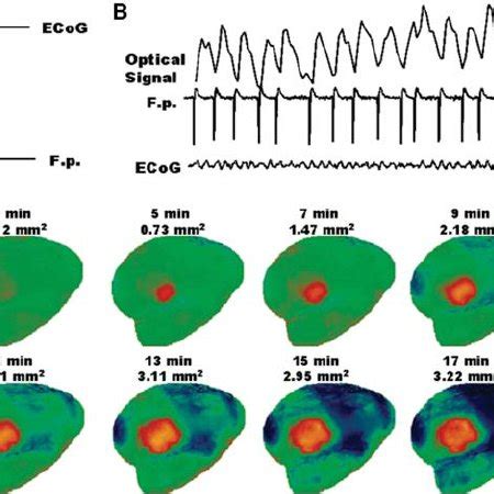 Optical Imaging Of Intrinsic Signals Reveals The Functional