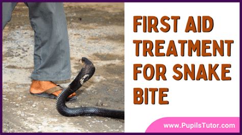 First Aid Treatment For Snake Bite