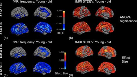 Resting‐state Functional Magnetic Resonance Imaging Rs‐fmri Frequency