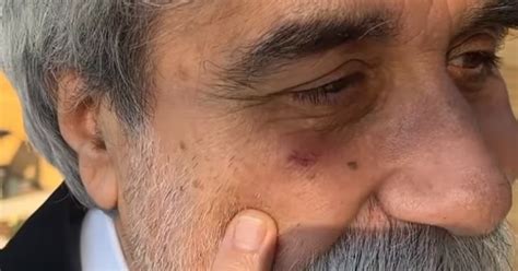 Beppe Vessicchio Non Vede La Vetrata Della Villa Di Fedez E Ci Sbatte