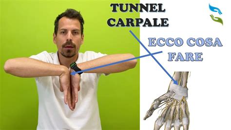 Sindrome Tunnel Carpale Test Ed Esercizi Medici Youtube It Works