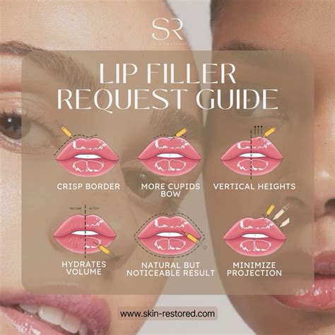 Lip Filler Inspiration Artofit